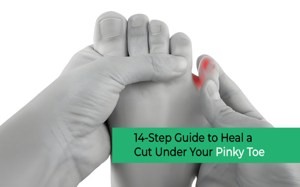 Crack in between pinky toe deals