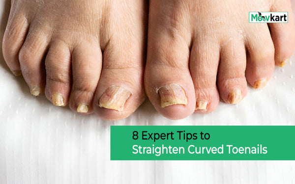 How to Straighten Curved Toenails - 8 Outstanding Tips