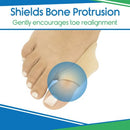 Vive Health Bunion Protector, Fabric Lined Gel, Washable, 4 Pack for Bunion Pain Relief